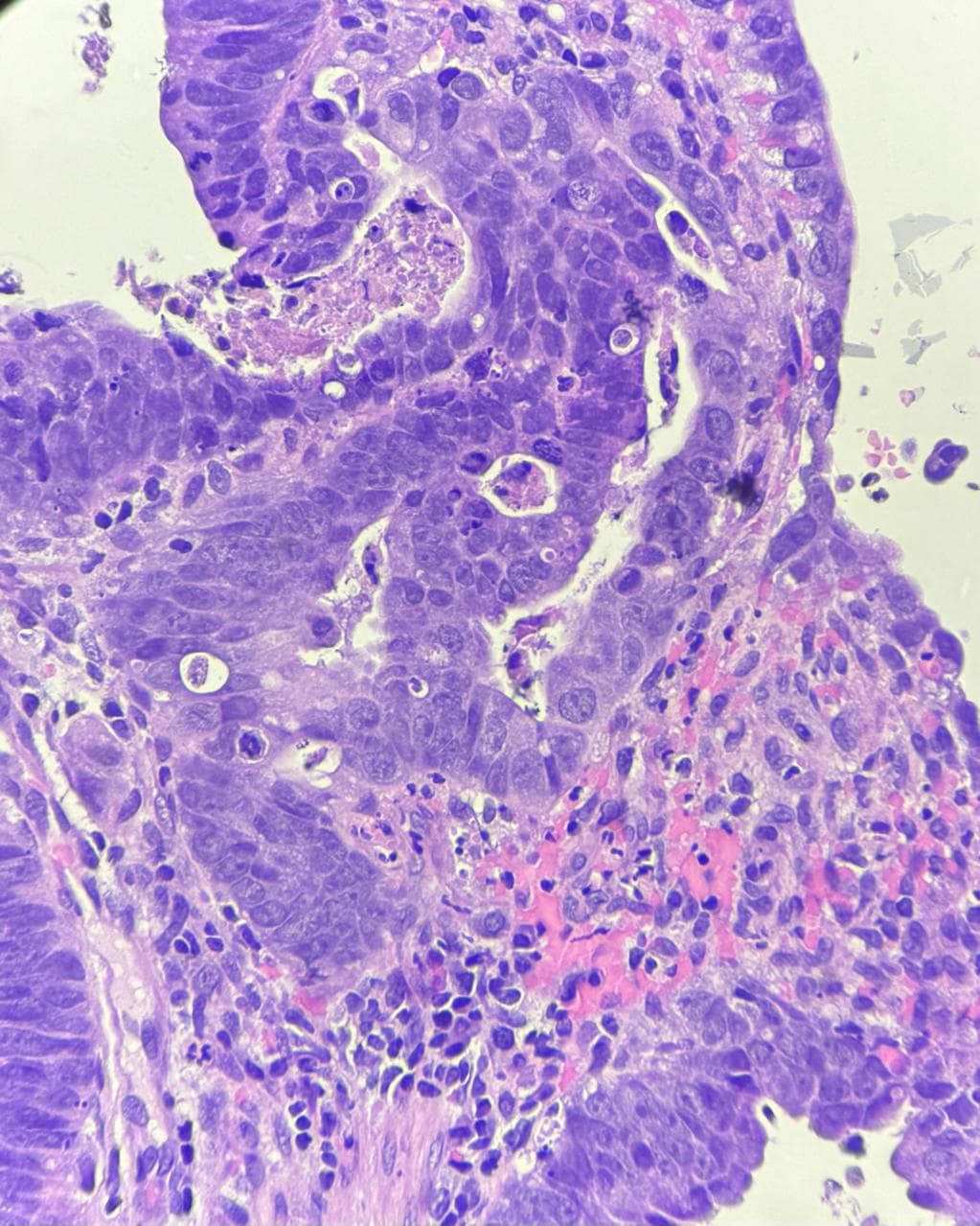 Histopatologia