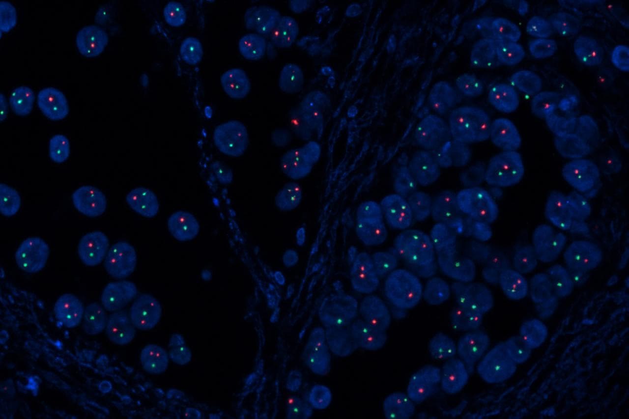Patologia Molecular